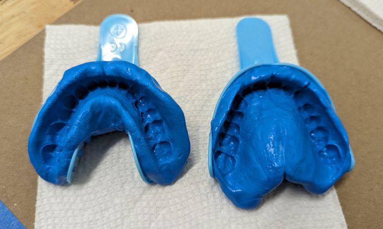 Silicone dental impressions