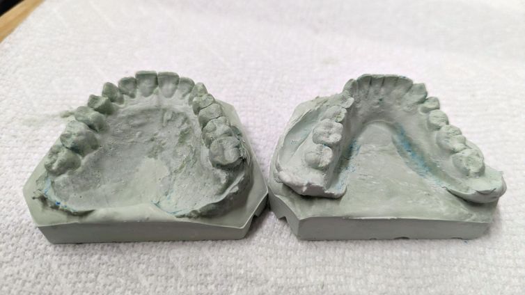 Die Keen Green Dental Stone Casting