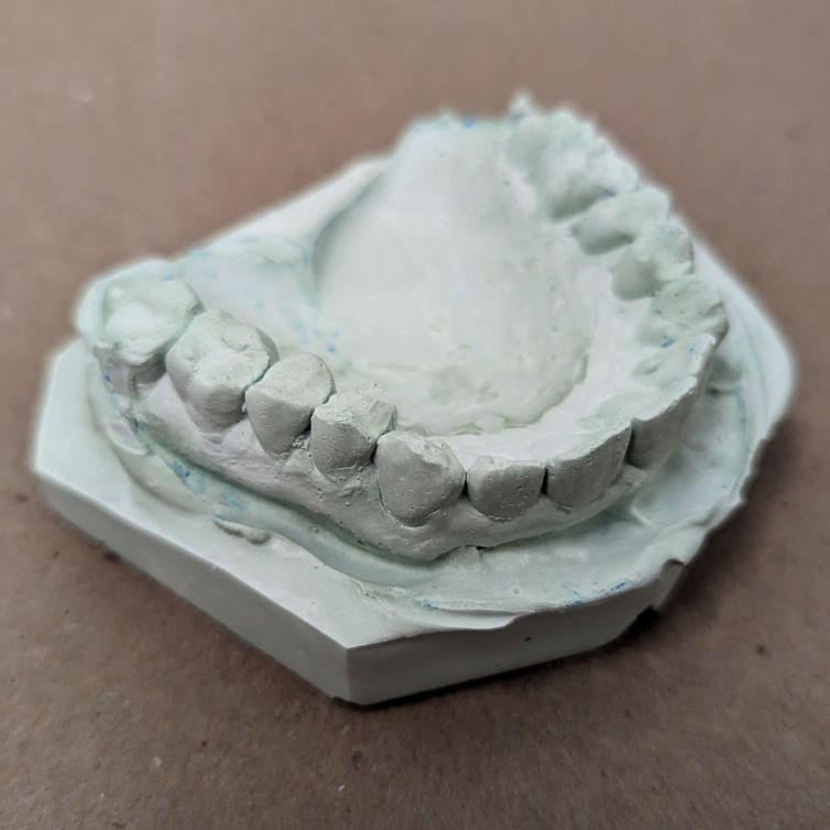 Dental stone lower casting