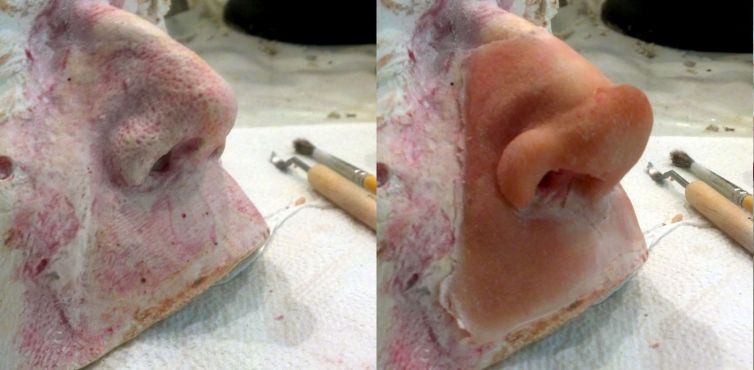 Custom gelatin nose prosthetic