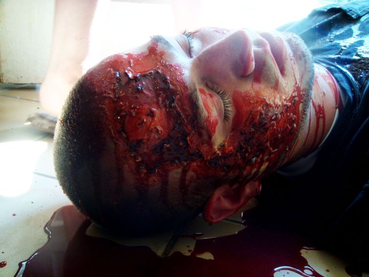 Bloody head wound